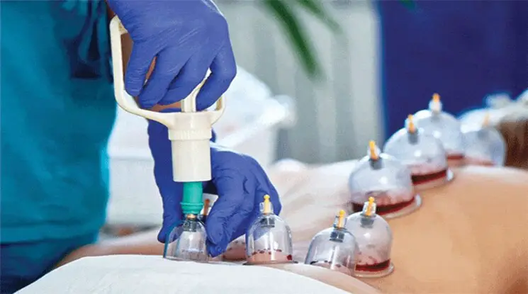 best hijama services